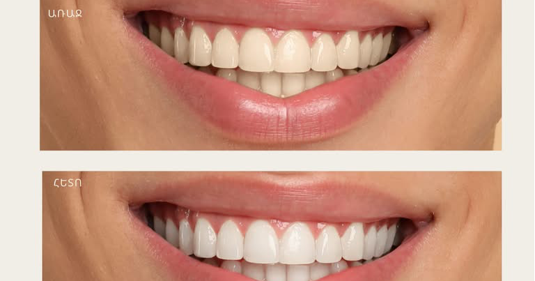 Dr. smile Facebook ad