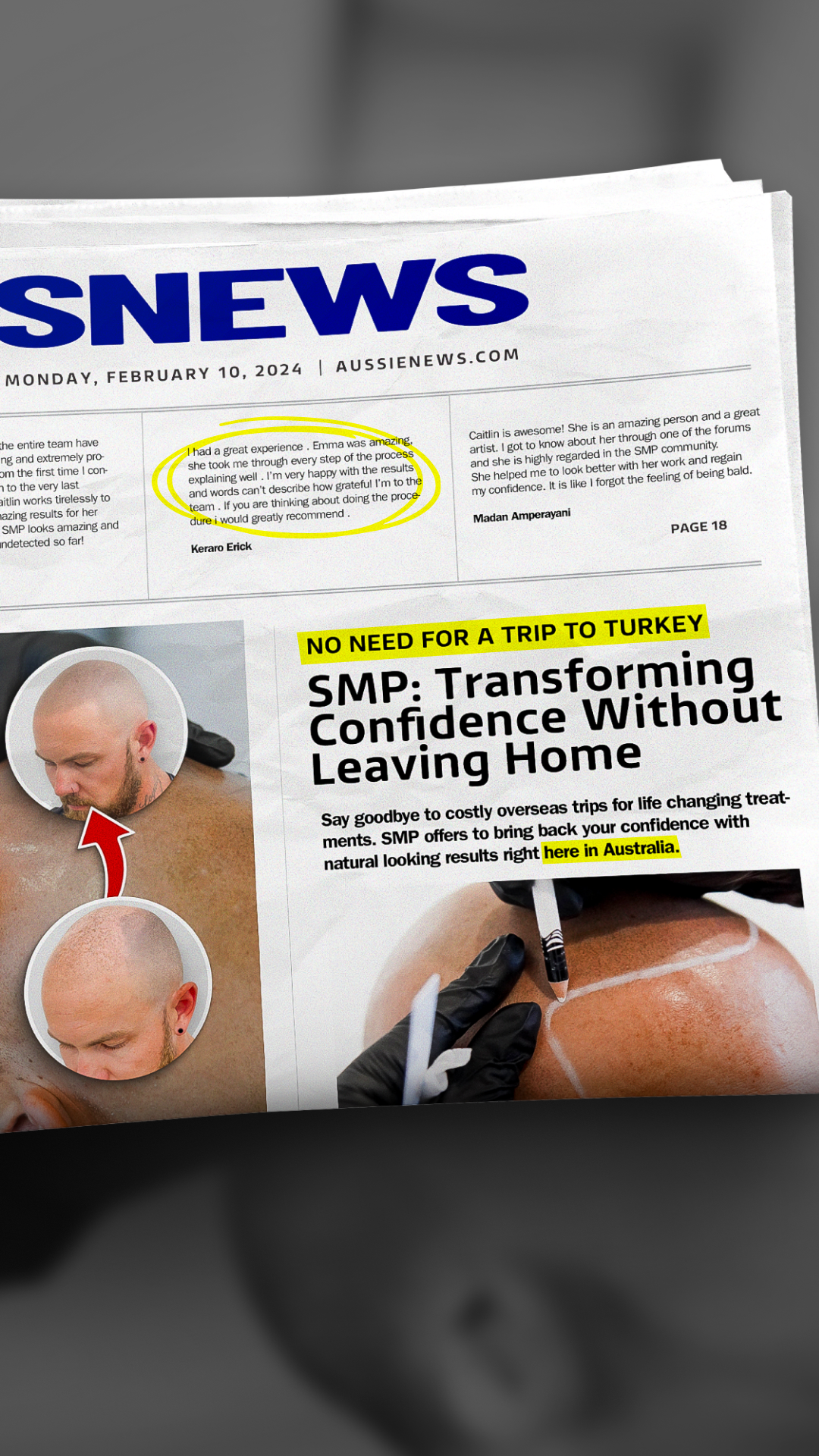 Scalp MicroPigmentation Australia Facebook ad