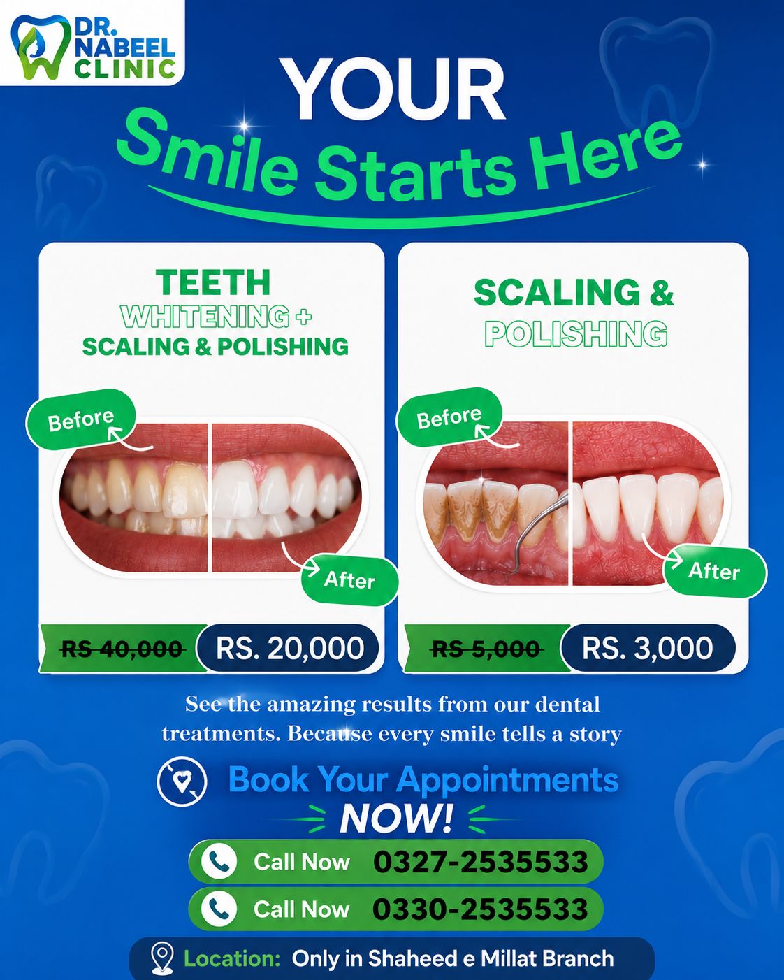 Dr Nabeel Dental Clinic Facebook ad: Big Smiles, Bigger Savings, Exclusive Discounts Now…