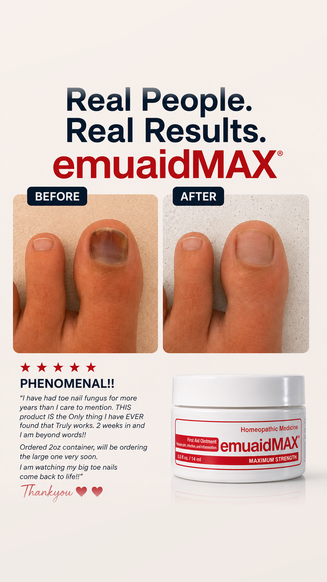 Emuaid Facebook ad