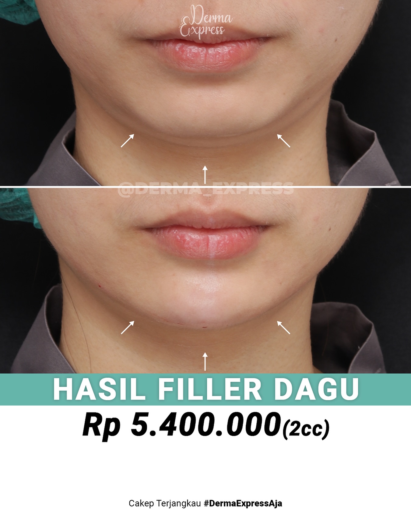 derma_express Facebook ad