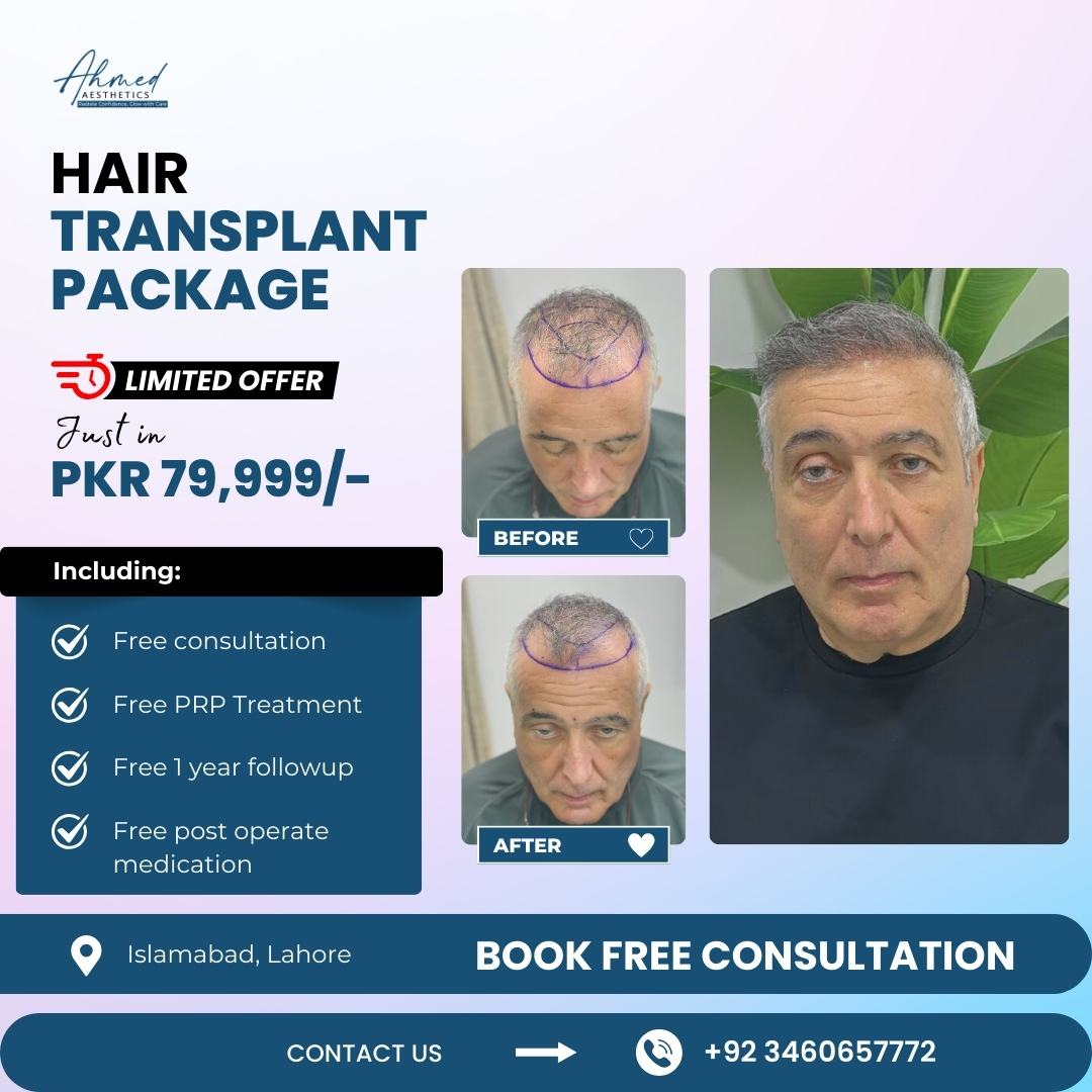 Ahmed Aesthetics Facebook ad: Get Full Hair Transplant Package
