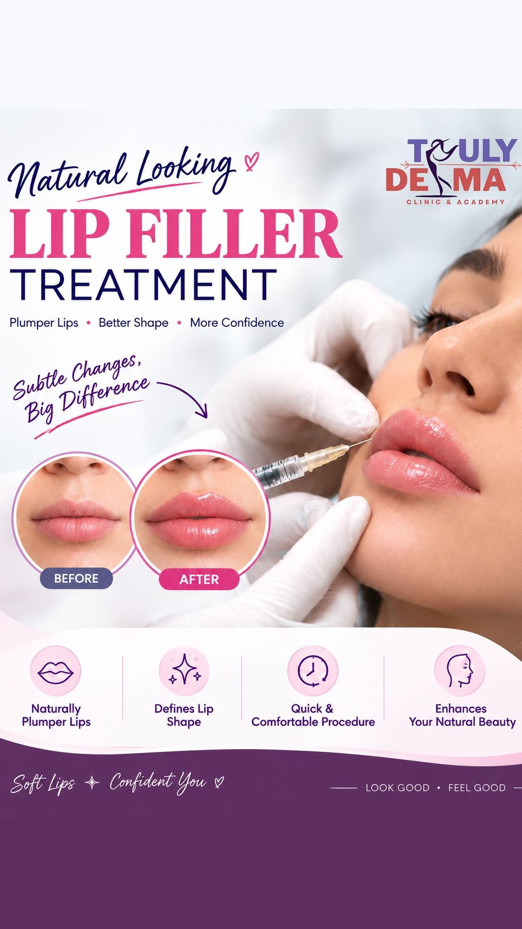 Truly Derma - Pitampura Facebook ad: Natural Looking Lip Fillers