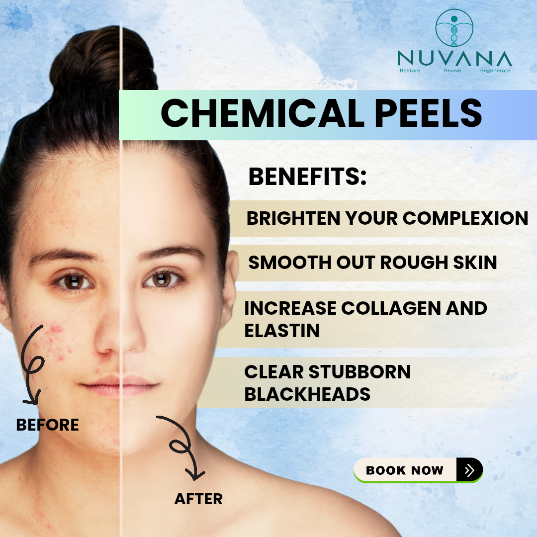 The Nuvana Life Facebook ad from Feb 24, 2026