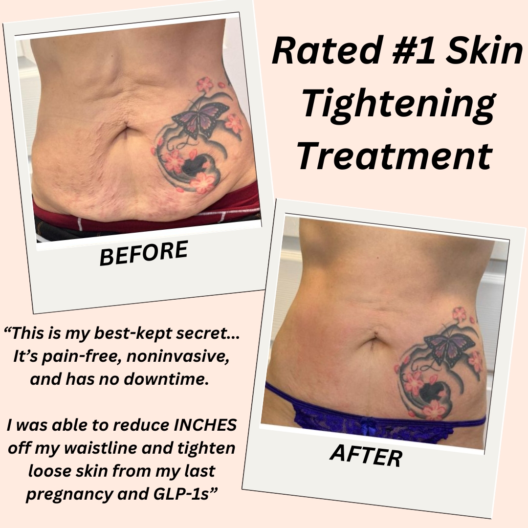 Studio Stiles Facebook ad: Tighten & Tone Transformation NOW $249