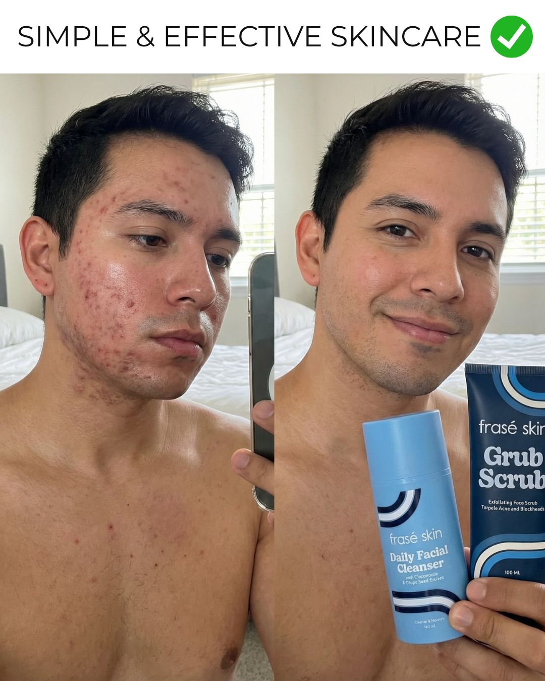 Frasé Skin Facebook ad