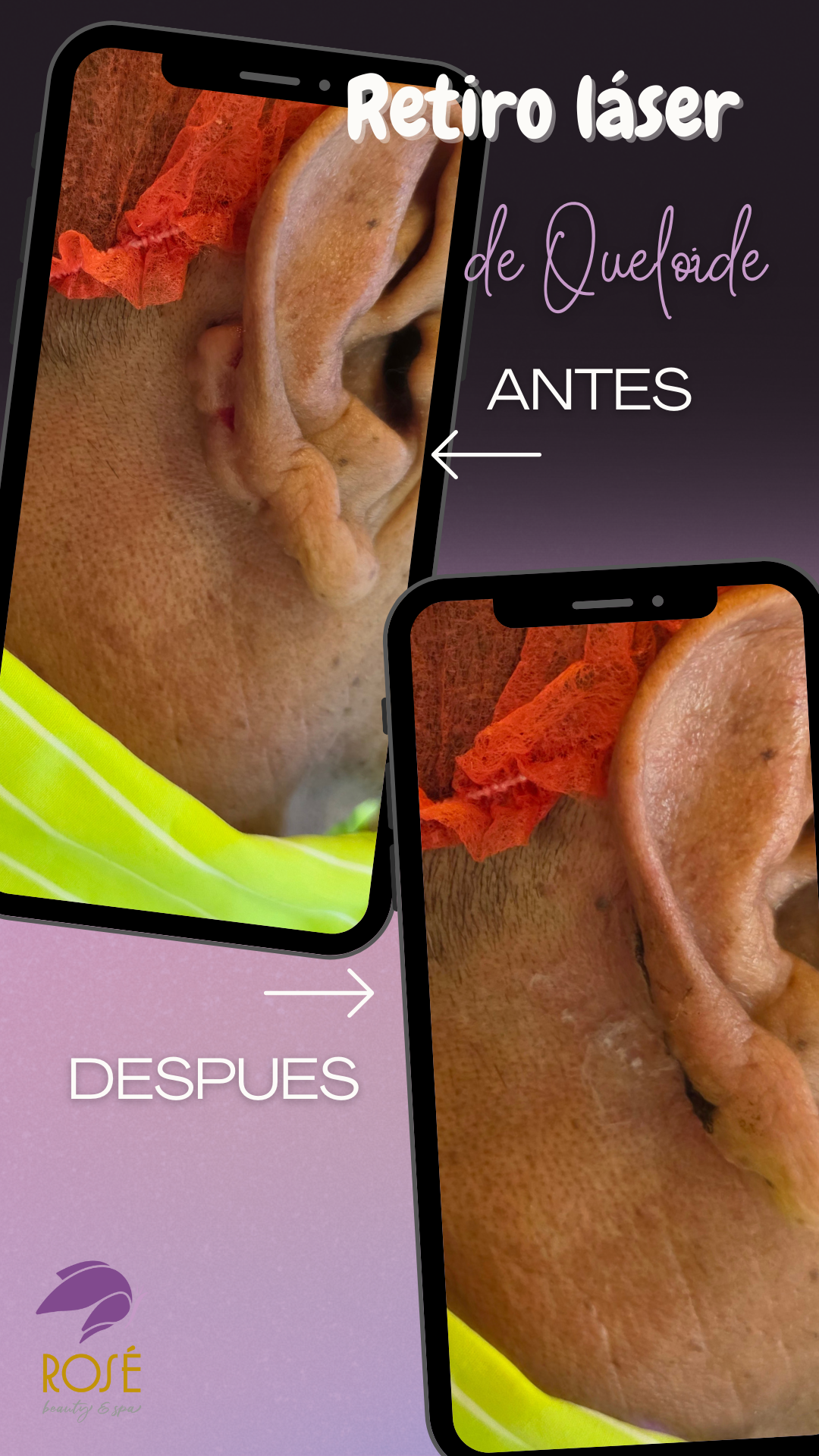 Rosé Beauty and Spa  Facebook ad
