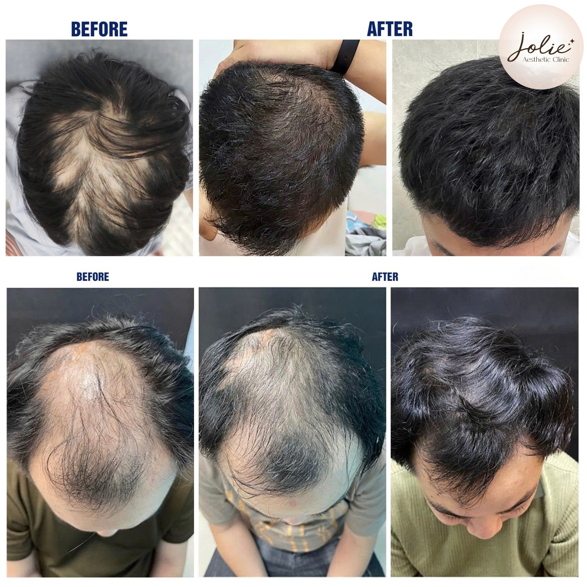 Jolie Beauty JohorBahru Facebook ad: HAIR LOSS ENDS HERE!