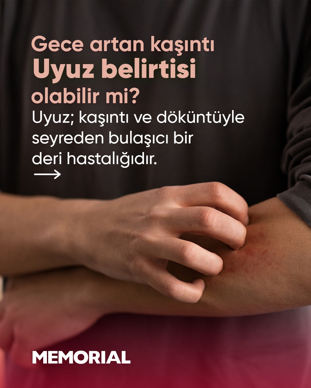 Memorial Facebook ad: Gece artan kaşıntı, uyuzun en sık görülen belirtilerinden…