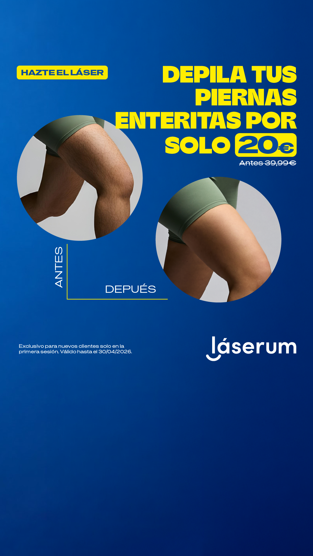 Láserum Facebook ad