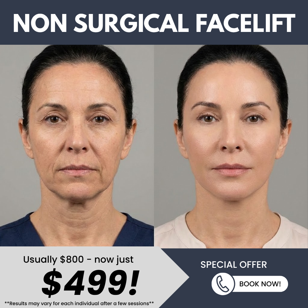 NuCell Skin MedSpa Facebook ad: Non-Surgical Facelift - ONLY $499!