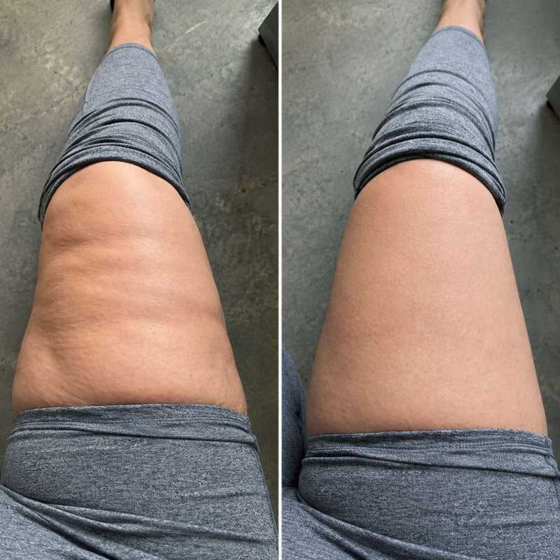 Lumya Facebook ad: Same Body. Better Shape.