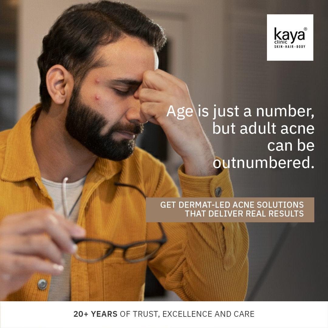 Kaya Clinic Facebook ad