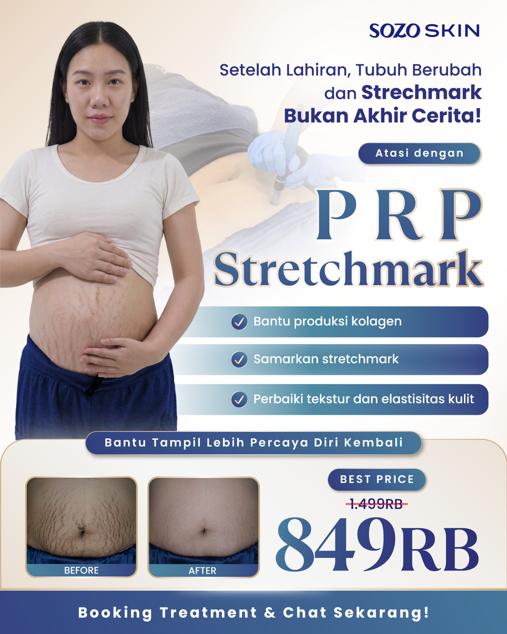 Sozo Skin Clinic Facebook ad