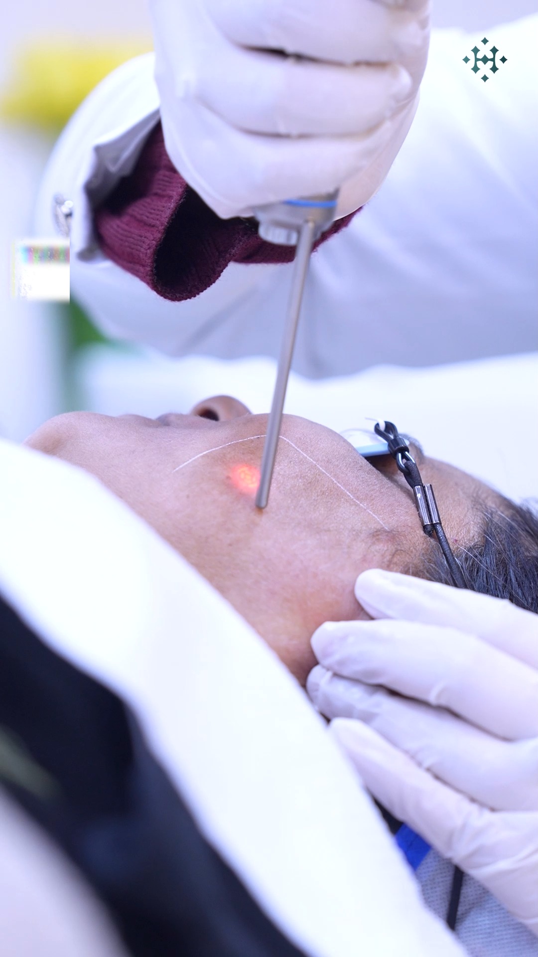Dr. Haror's Wellness Facebook ad: Acne marks? Pigmentation?