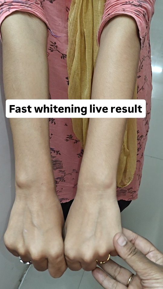 Hooshiyaa Facebook ad: Fast whitening live result