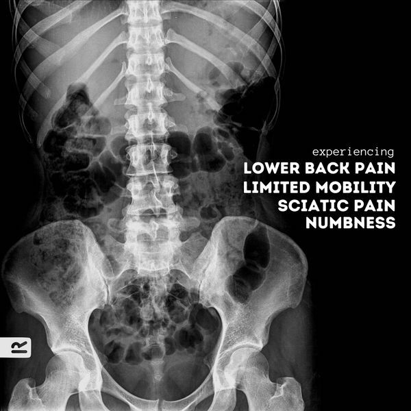 Real Life Chiropractic Aus Facebook ad