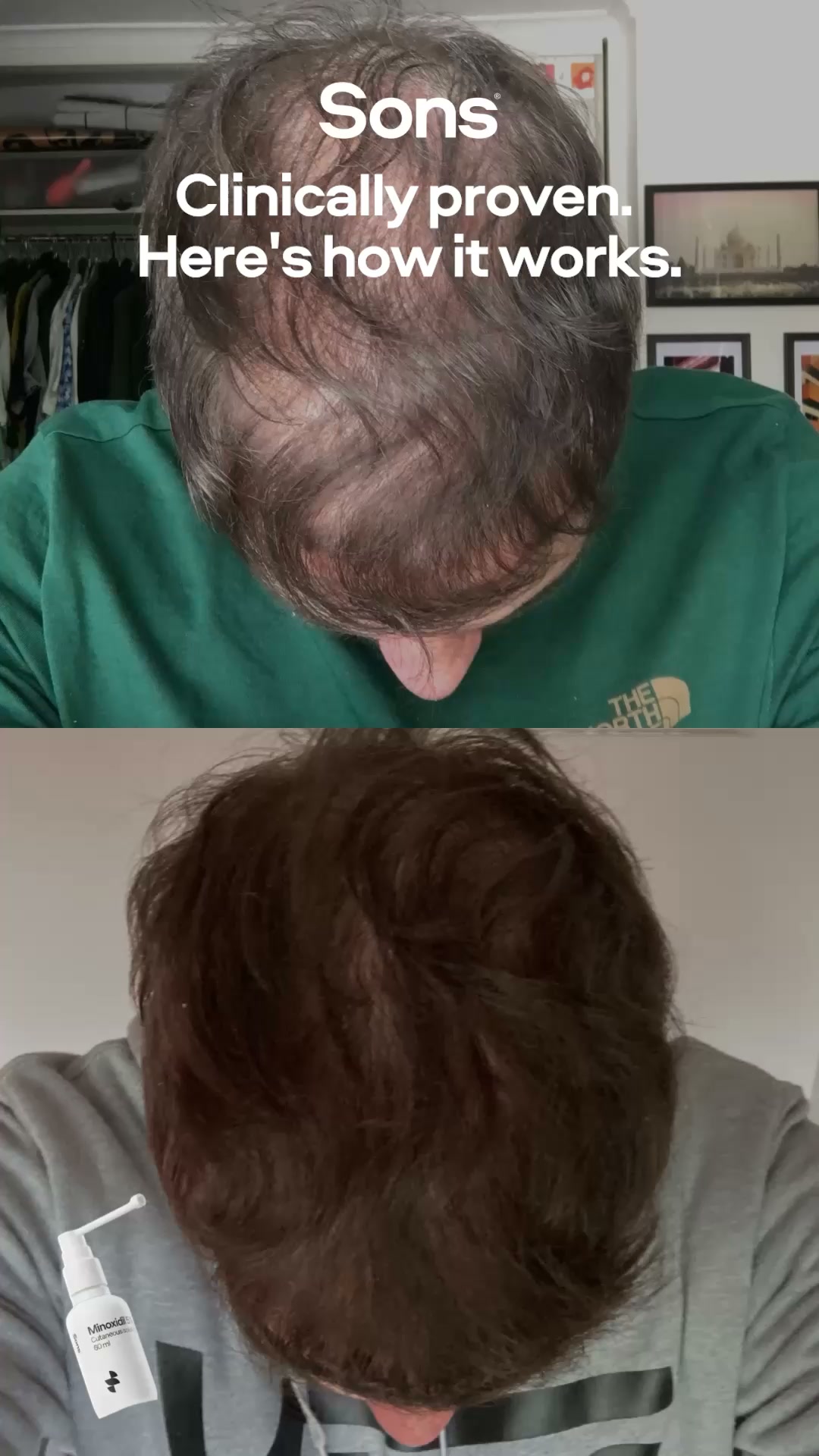 Sons Facebook ad: Your hairline. Your call.