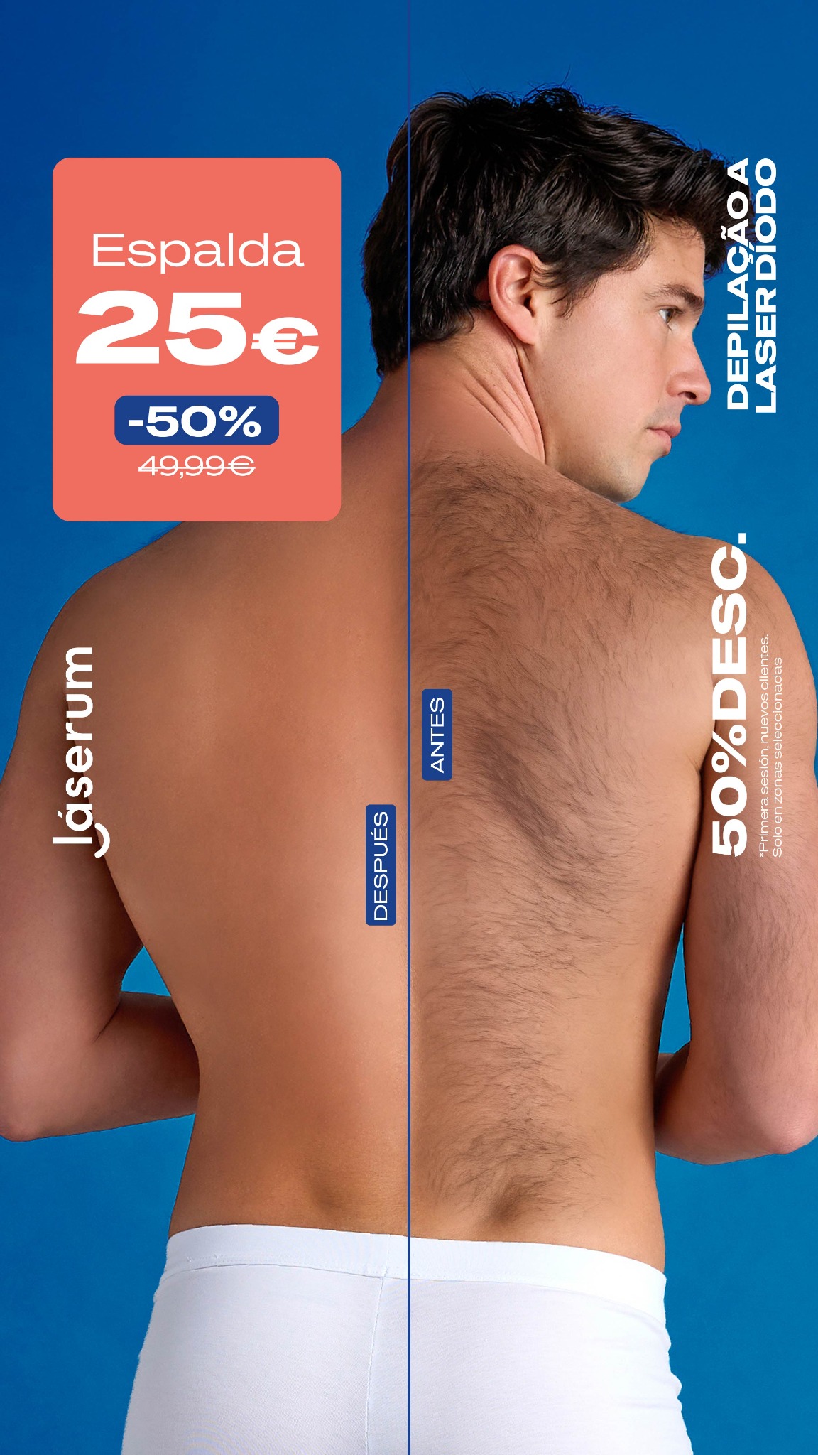 Láserum Facebook ad