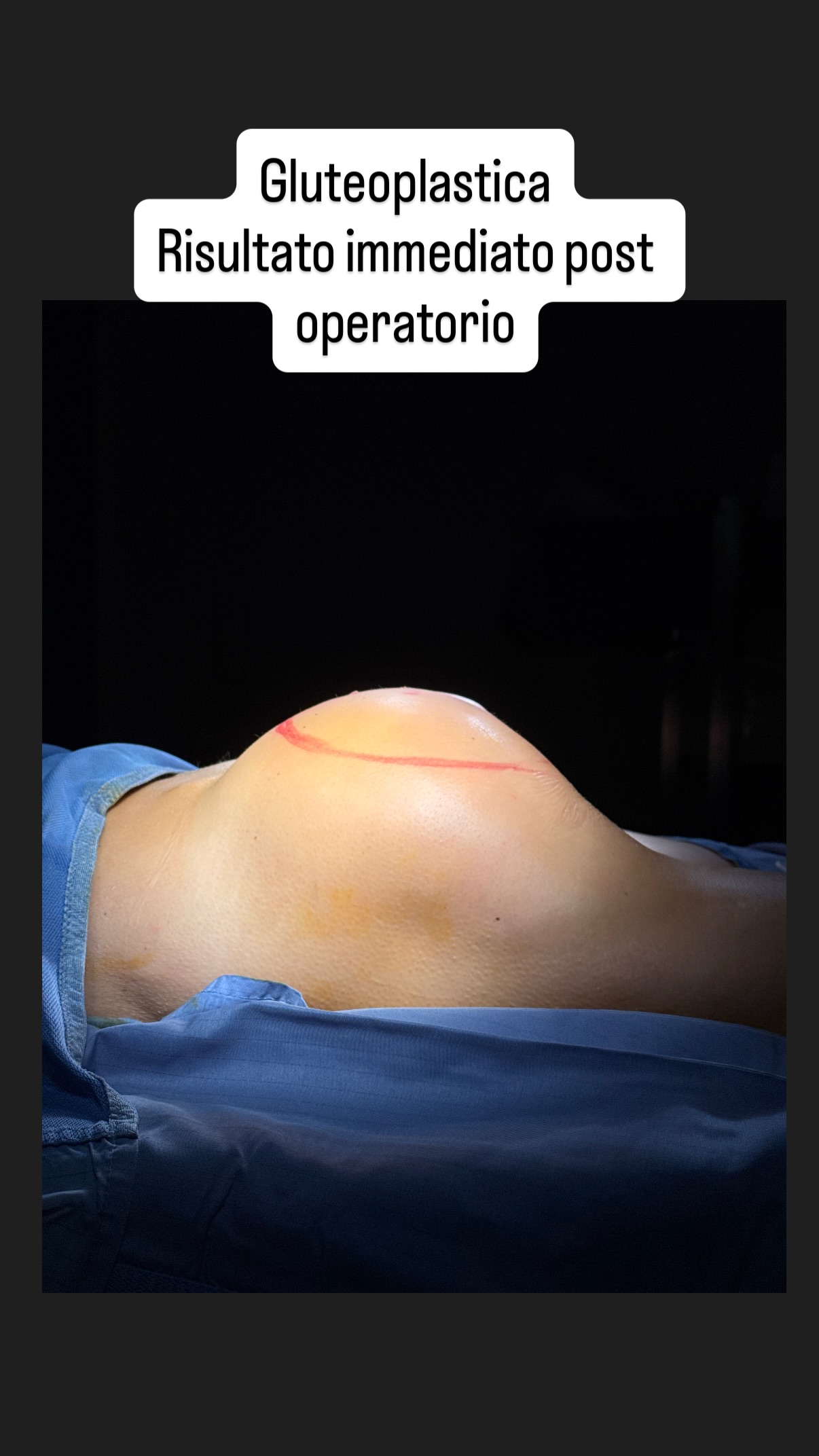 Aesthetic Medicine Clinic Facebook ad