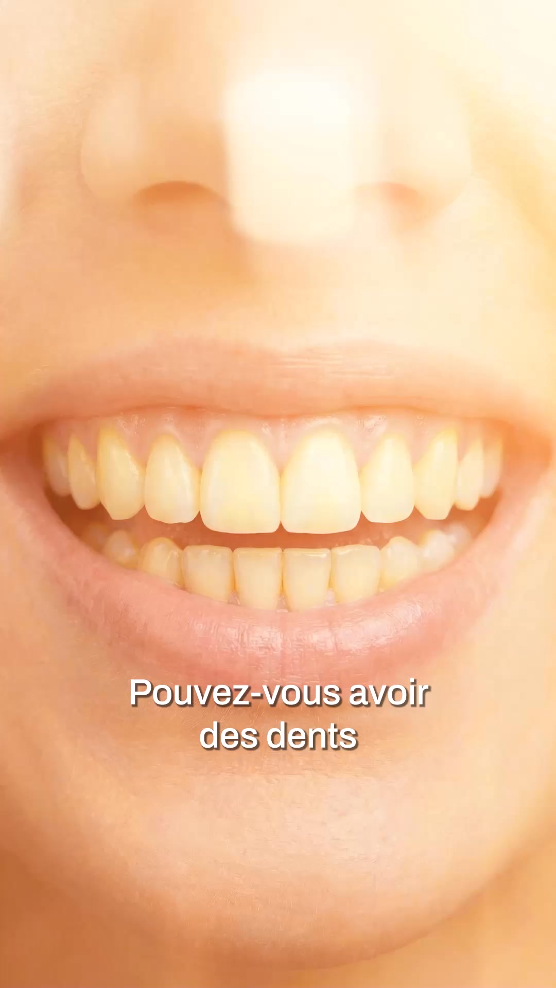 My Variations Facebook ad: 95% remarquent un éclat visible