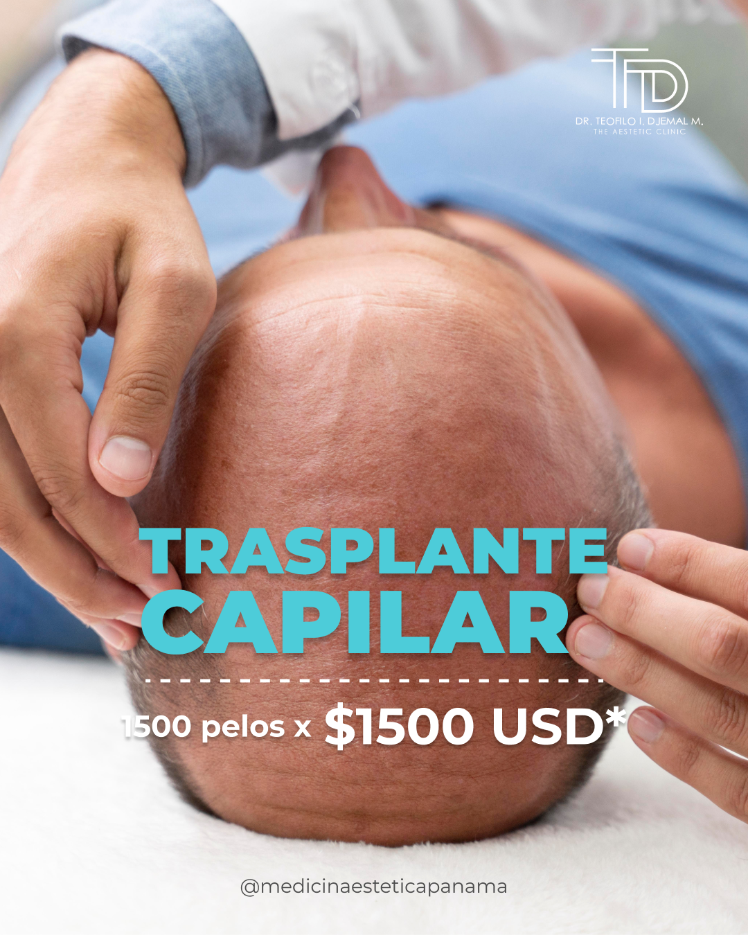 Medicina Estética Panamá Facebook ad: ¿Estás perdiendo cabello y no sabes cómo detenerlo?