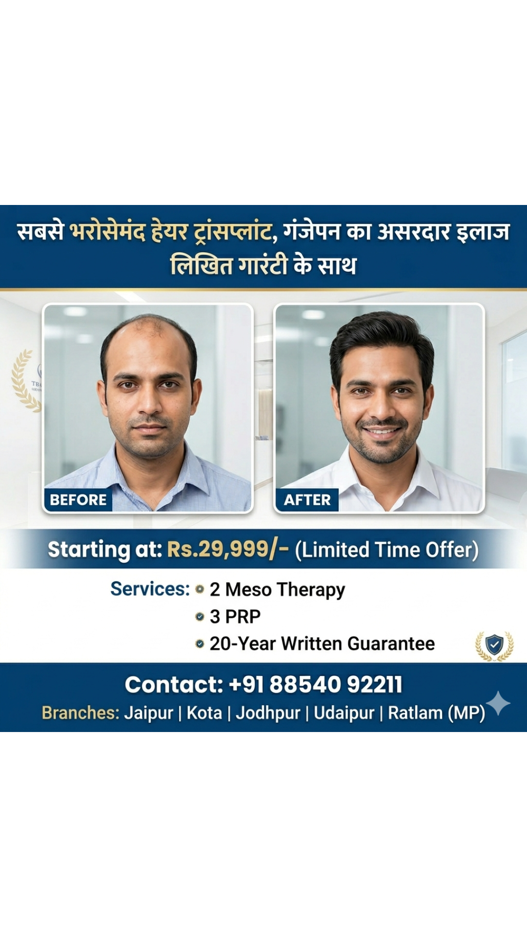 Best hair Transplant in Rajsthan-Udaypur-Kota,Jodhpur,Jaipur Facebook ad