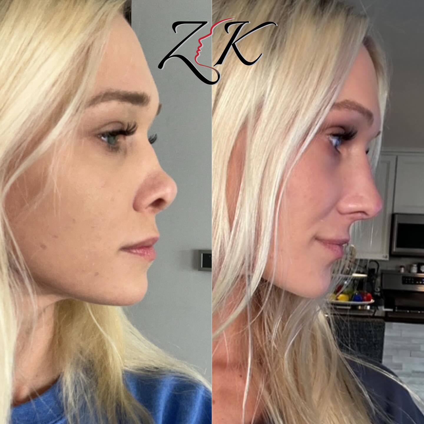 zknoses Facebook ad: Thank you to our patient for letting us…