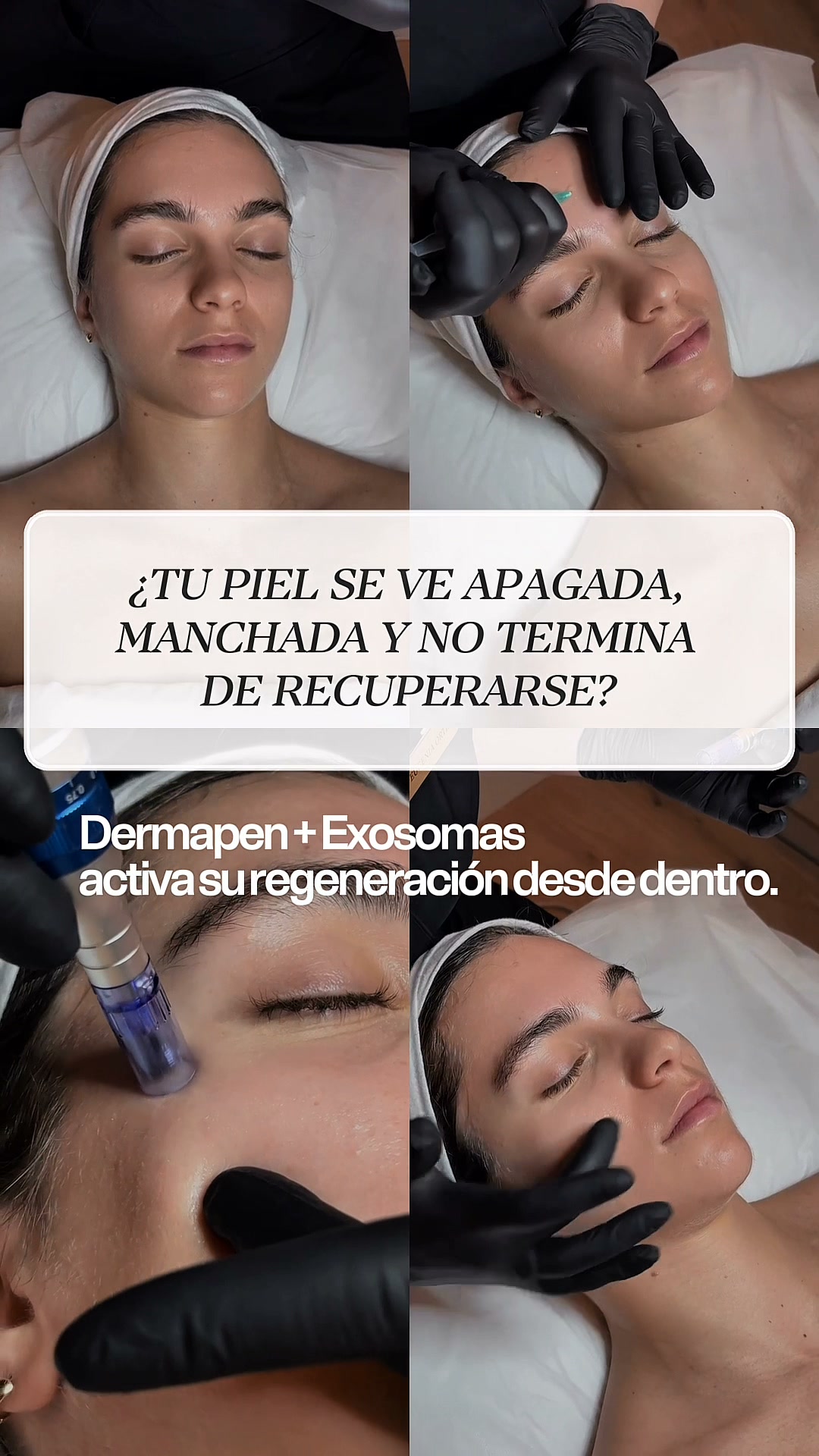 Beldon Beauty Facebook ad: Devuélvele vida a tu piel