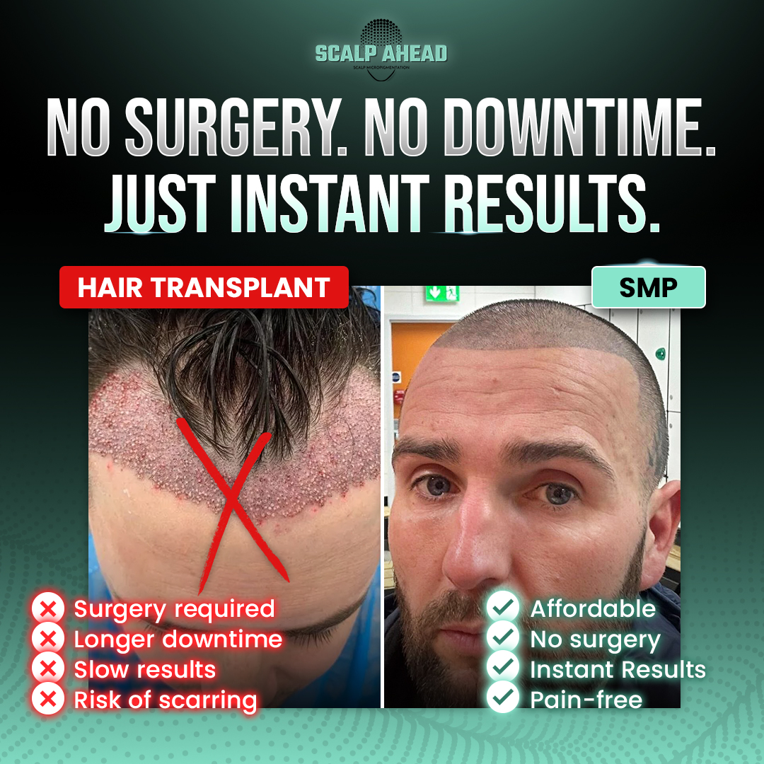 Scalp Ahead  Facebook ad