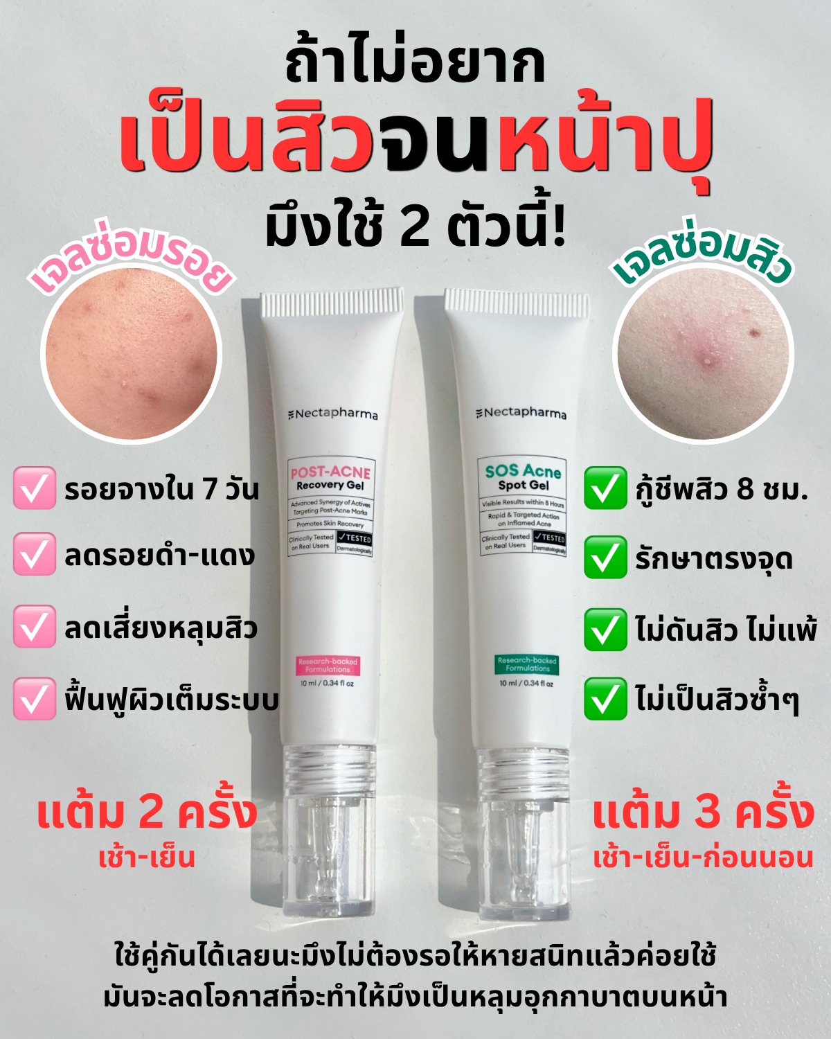 เก็บมาเล่า Facebook ad