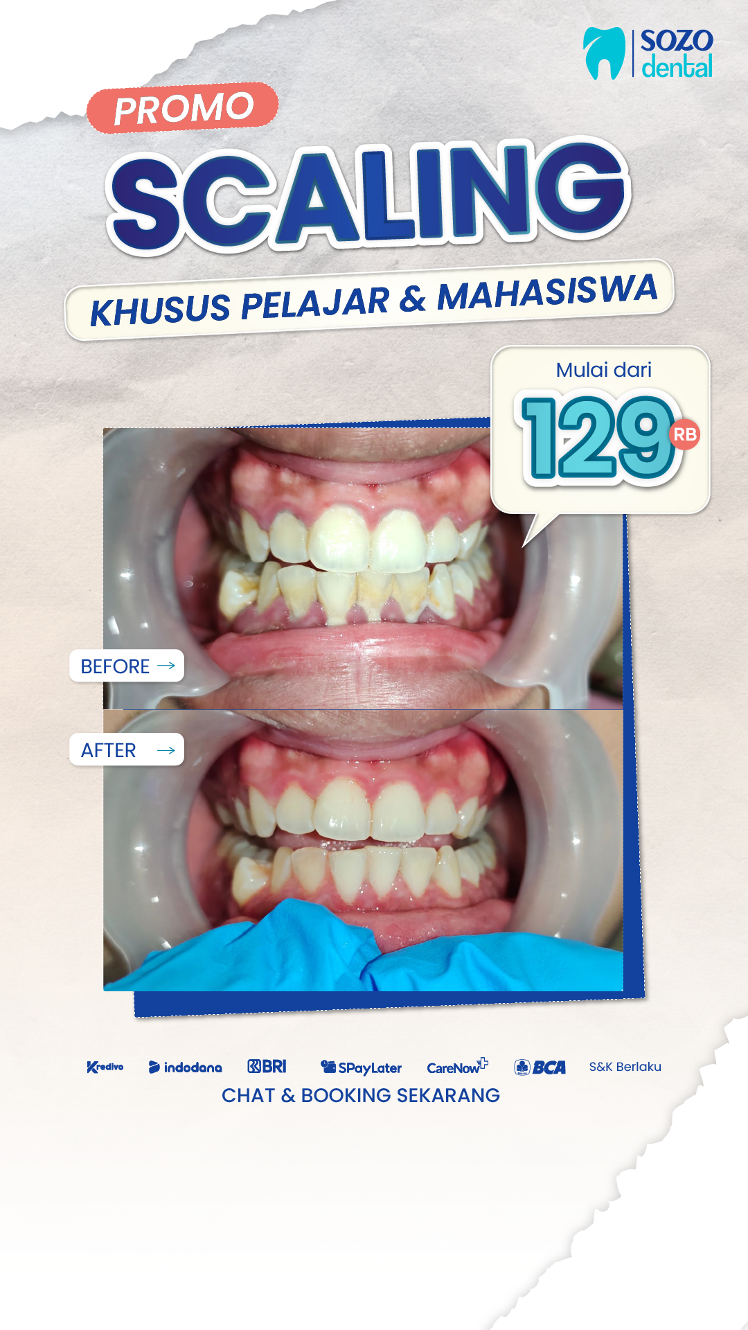 Sozo Dental Clinic Facebook ad