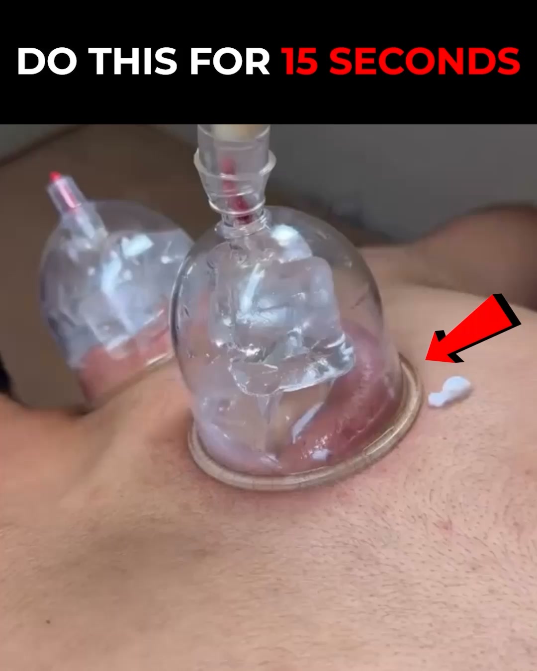 Honex Facebook ad: Fix Snoring & Sleepless Nights