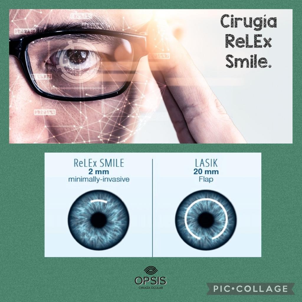 OPSIS - Cirugía Ocular Facebook ad: Recuperá tu visión y olvidate de los lentes