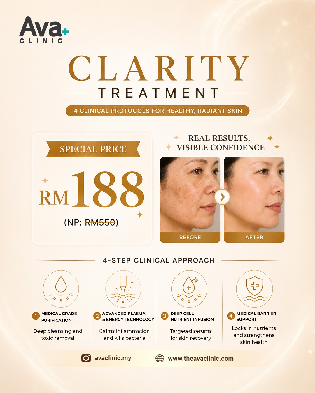 Ava Clinic Malaysia Facebook ad: Special Trial Price: RM188 Only
