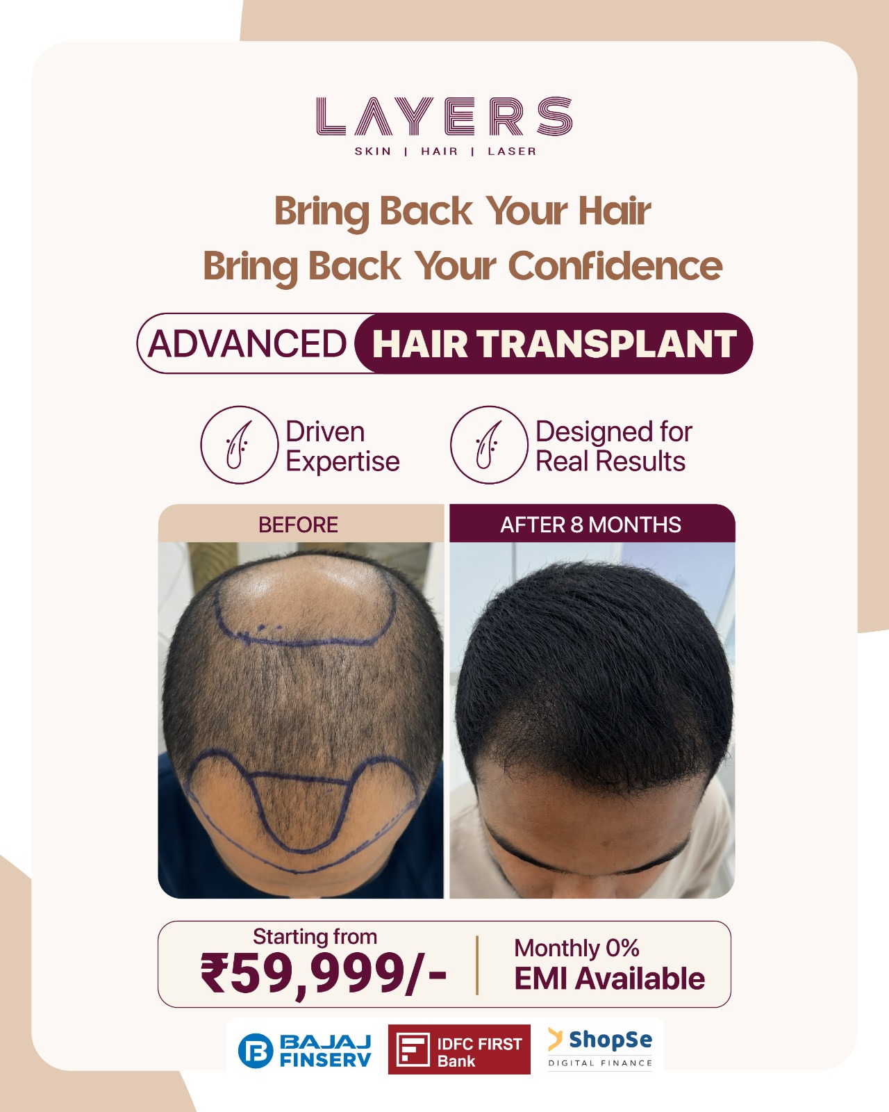 Layers Clinics Facebook ad