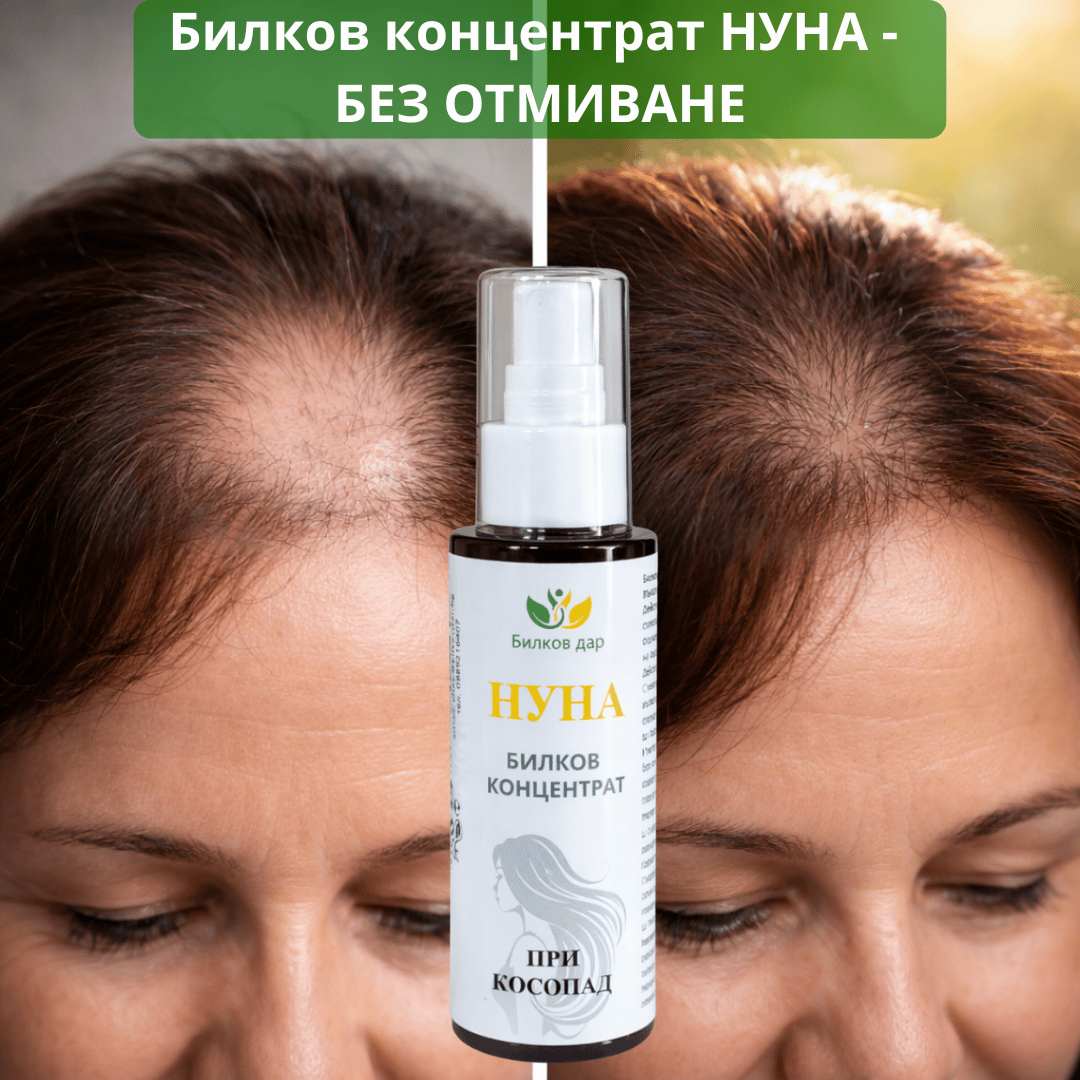 Билков Дар Facebook ad: ЗАБРАВИ ЗА КОСОПАДА