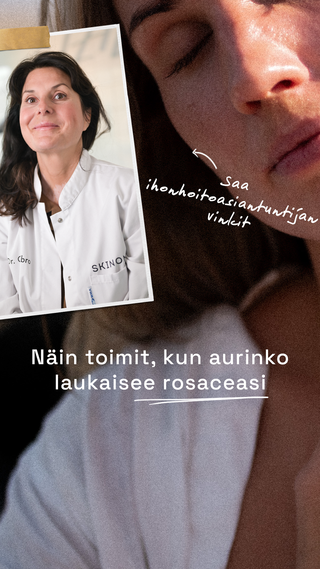 Skinome Facebook ad