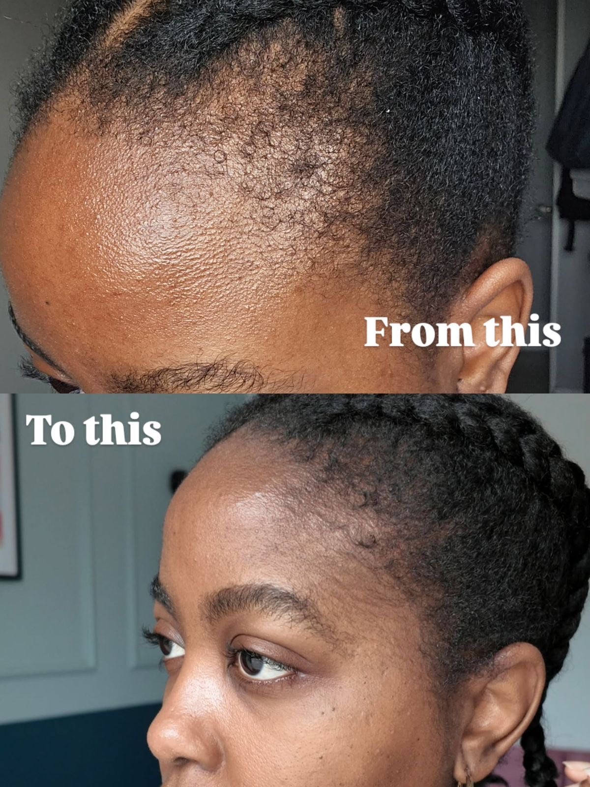 Millionhairsorganics Llc Facebook ad from Mar 26, 2026