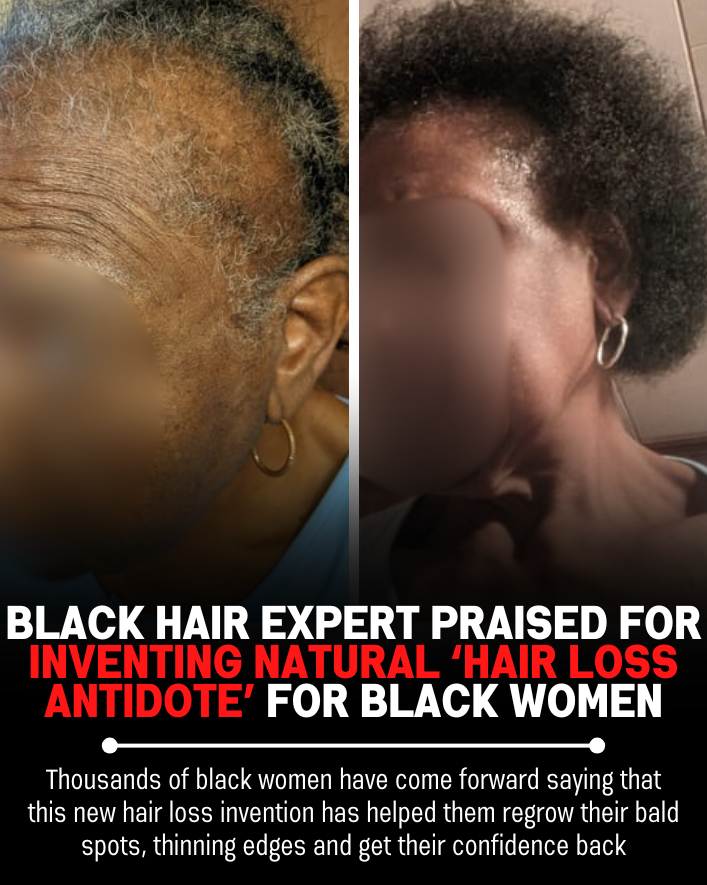 Black Hair Growth Remedy Facebook ad