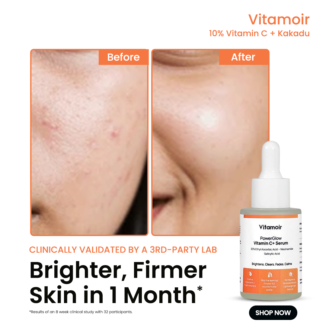 Vitamoir Facebook ad: Free Shipping - Free COD