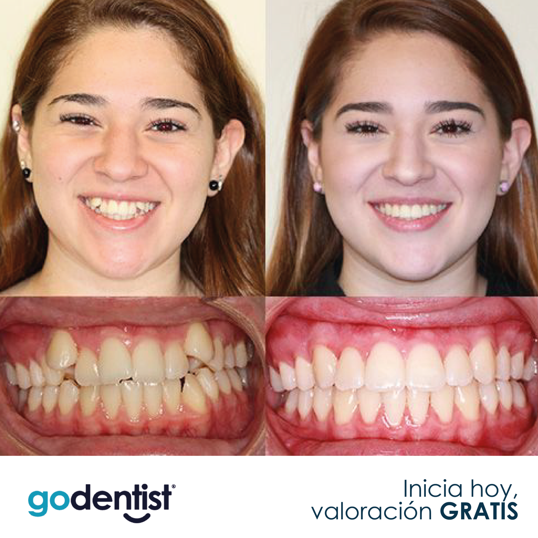 Clínicas Odontológicas Go Dentist Facebook ad