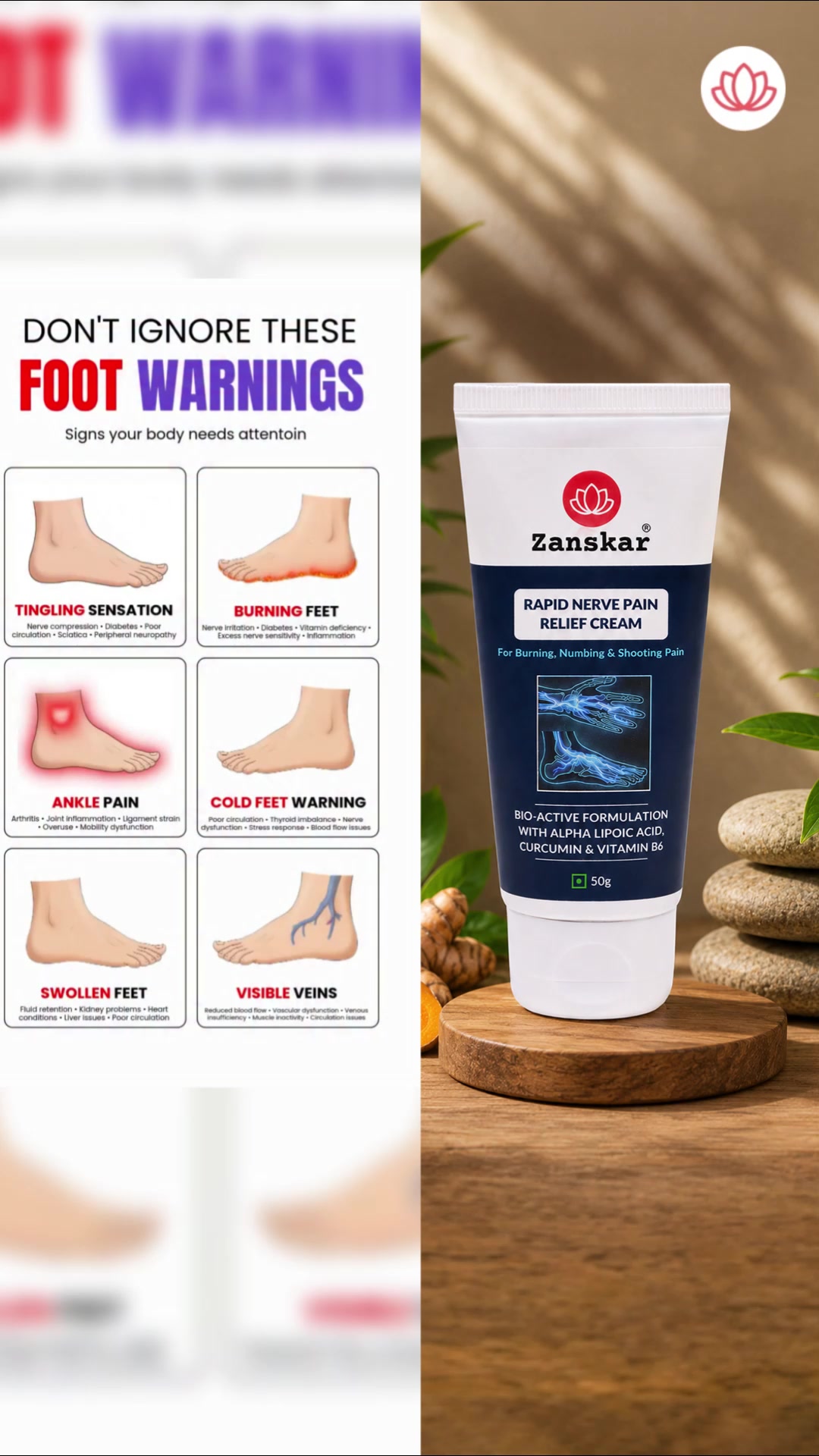 Zanskar: Muscle & Joint Relief Facebook ad: Burning, Tingling Feet? Try Zanskar