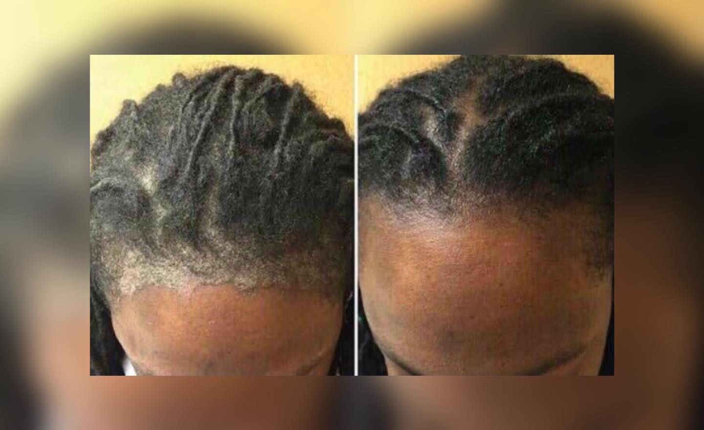 ONAGA cosmetics Facebook ad: SCALP AND SKIN SOLUTION SET (VOOR HOOFD EN…