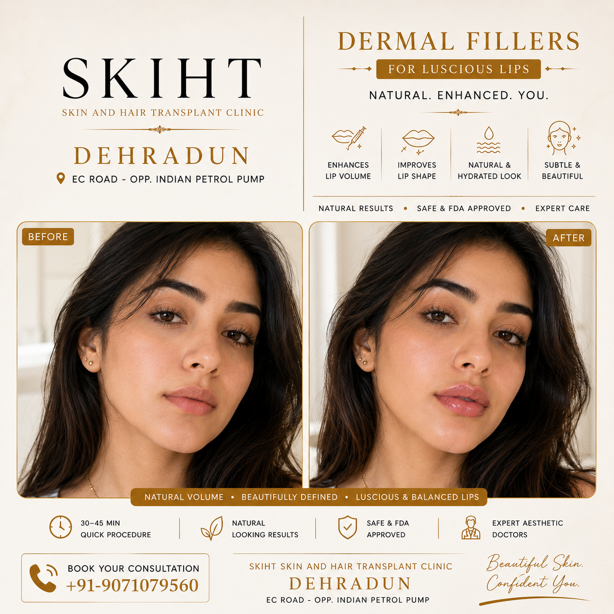 SKIHT - Skin & Hair Transplant Clinic Dehradun Facebook ad: SKIHT - Dehradun's #1 Skin & Hair Transplant Clinic…