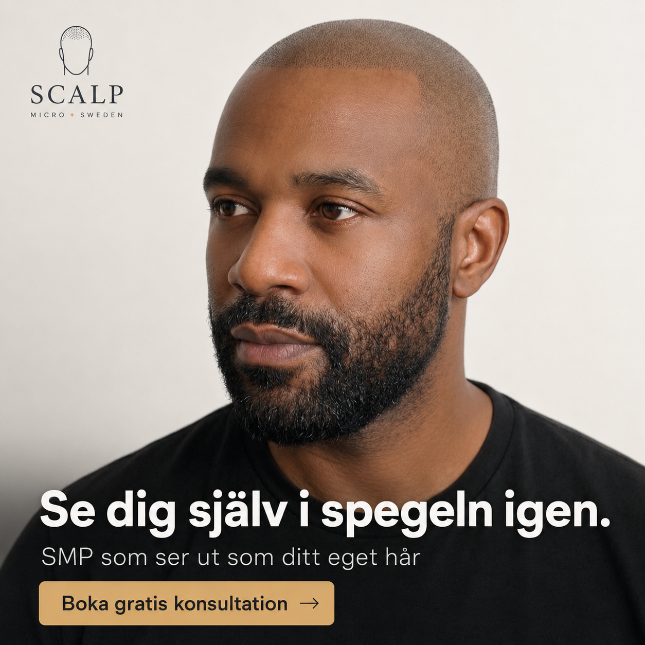 Scalp Micro Sweden SE Facebook ad: Boka din gratis konsultation