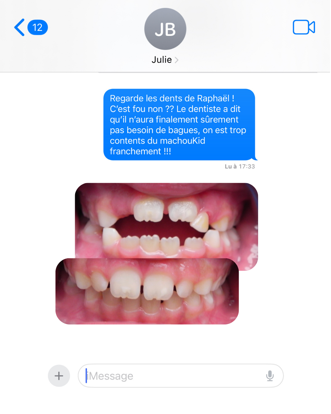 Machouyou Facebook ad from Jul 7, 2026