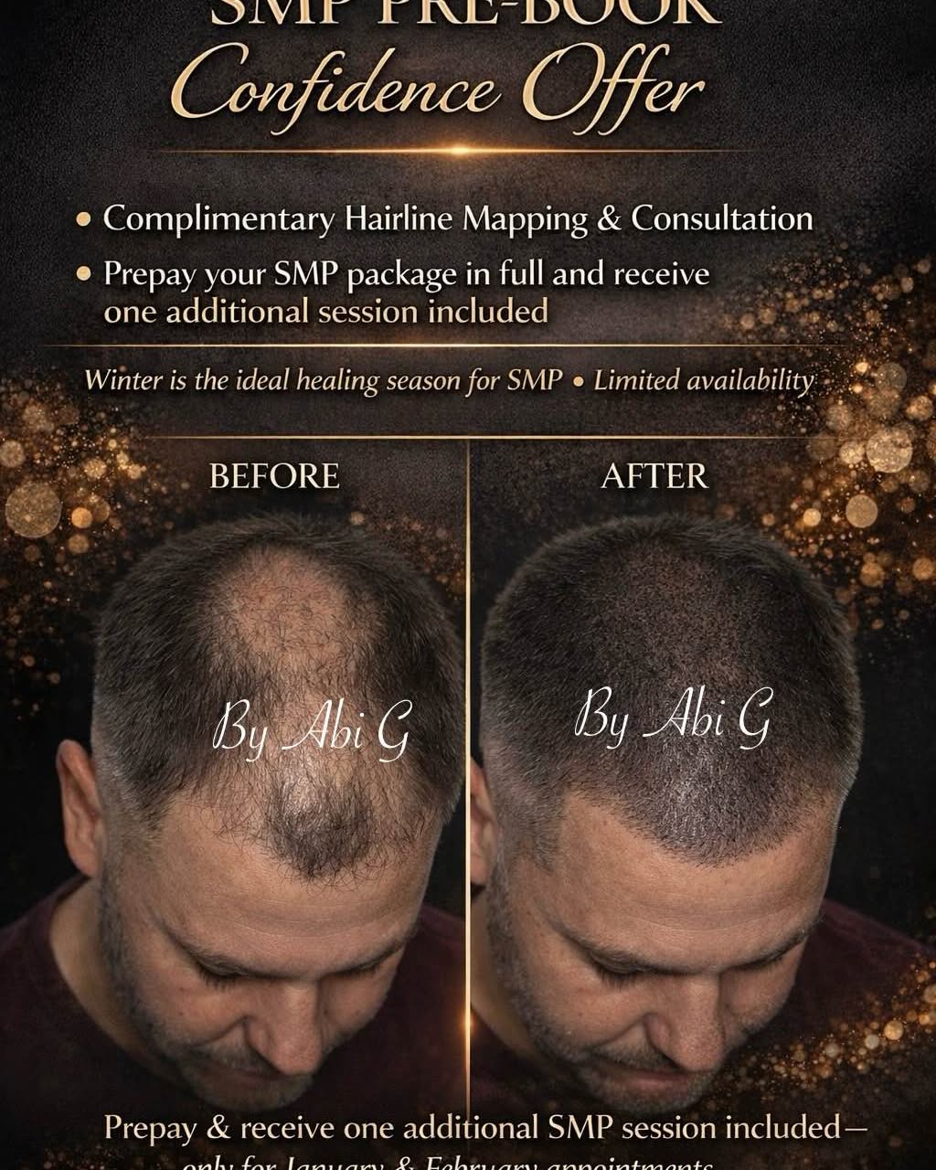 Abi Giummara Facebook ad: SCALP MICROPIGMENTATION (SMP), HAIRLINE & CROWN RESTORATION