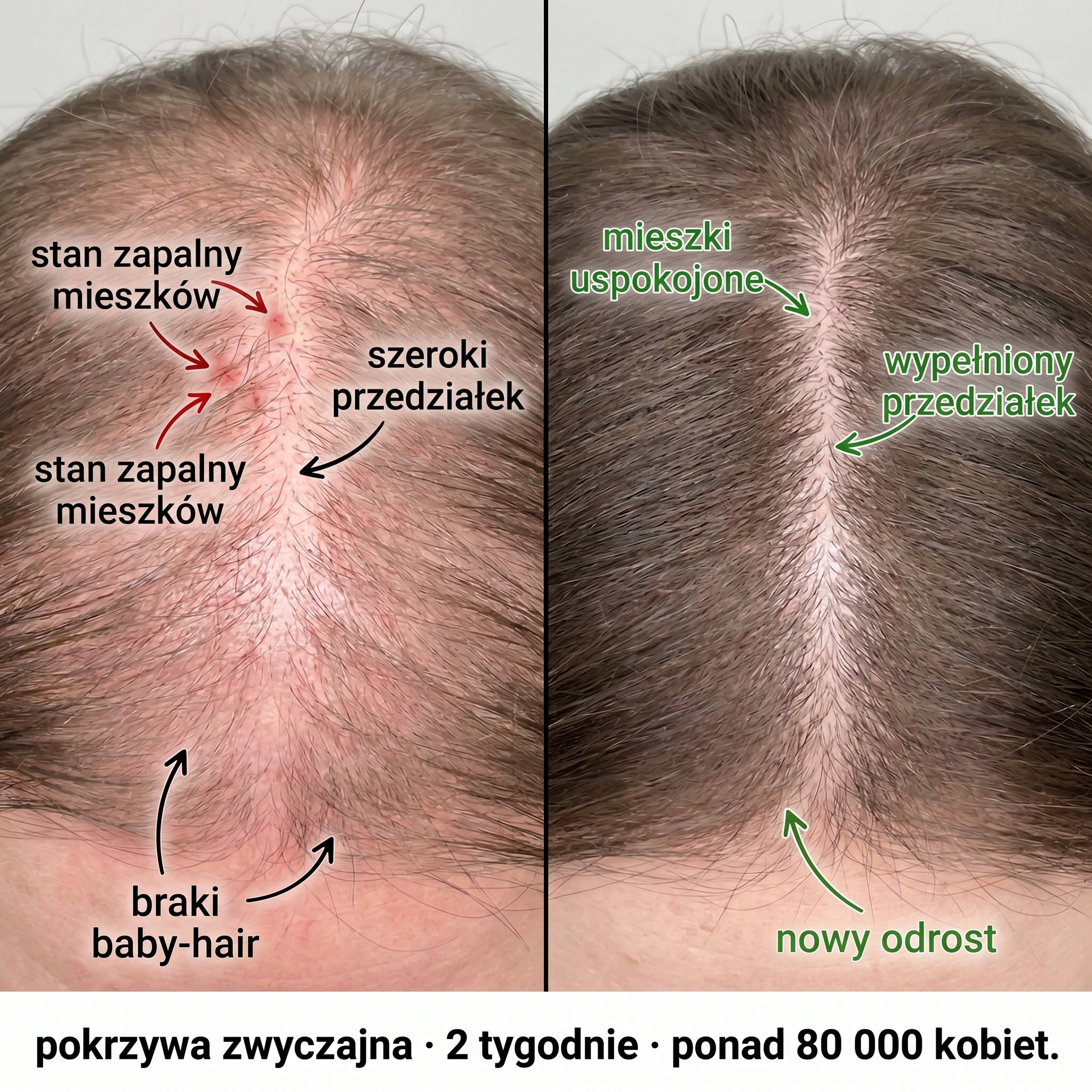 Kosmetyki Organiczne - InaEssentials.pl Facebook ad: Twoja skóra głowy za 2 tygodnie