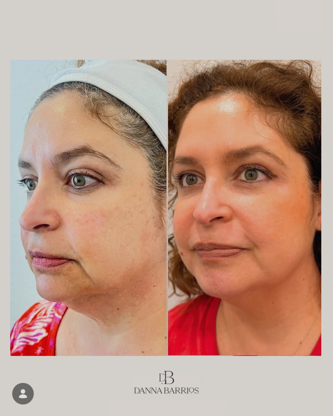 dradannabarrios Facebook ad: Natural beauty is the result of a well-designed…